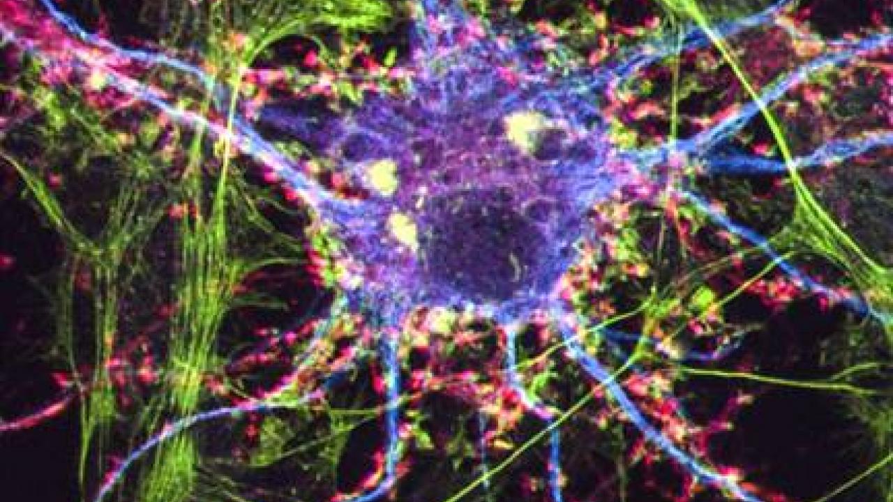 Image of brain neuron